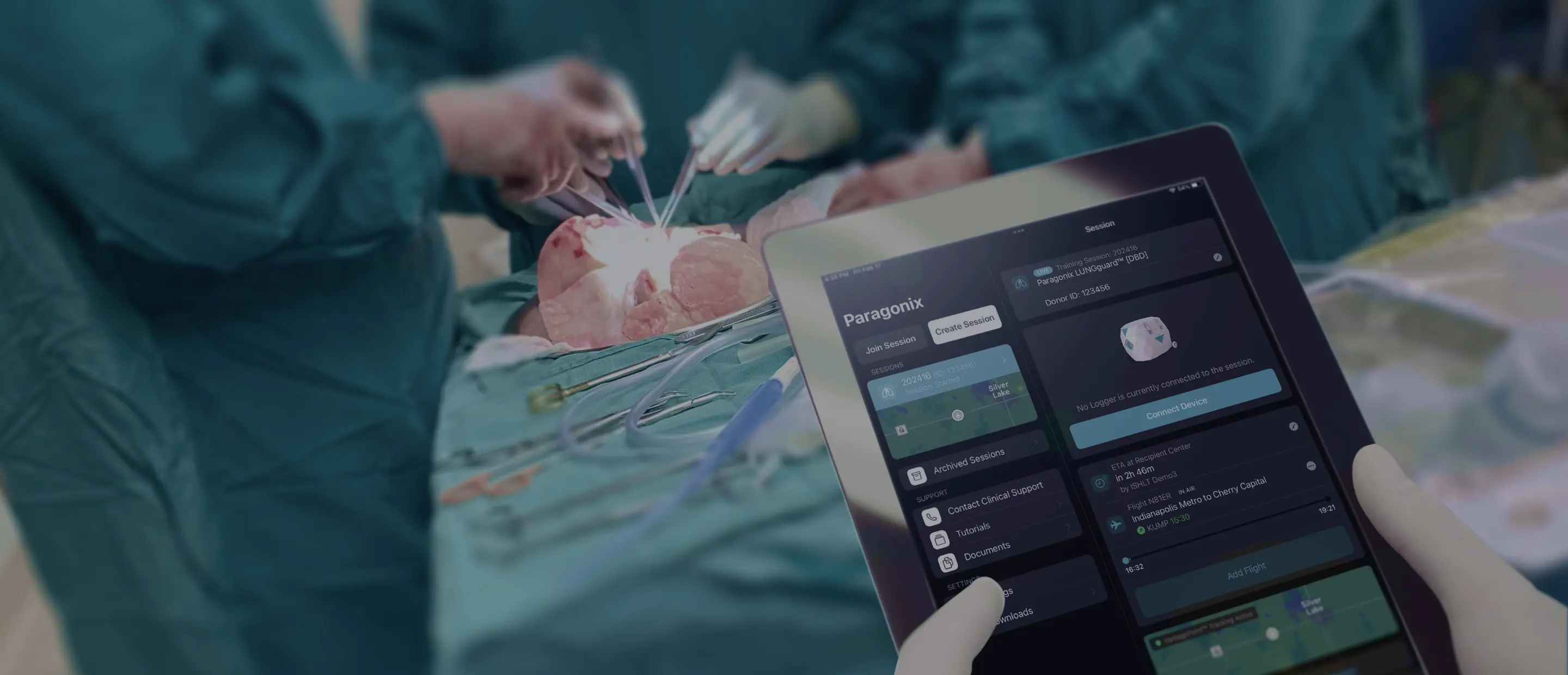 Advancing Donor Lung Preservation Paragonix